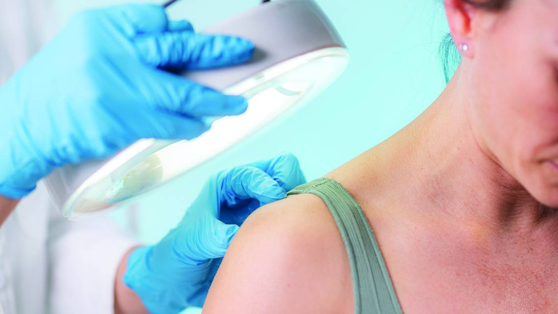 dermatology images
