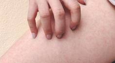 scratching