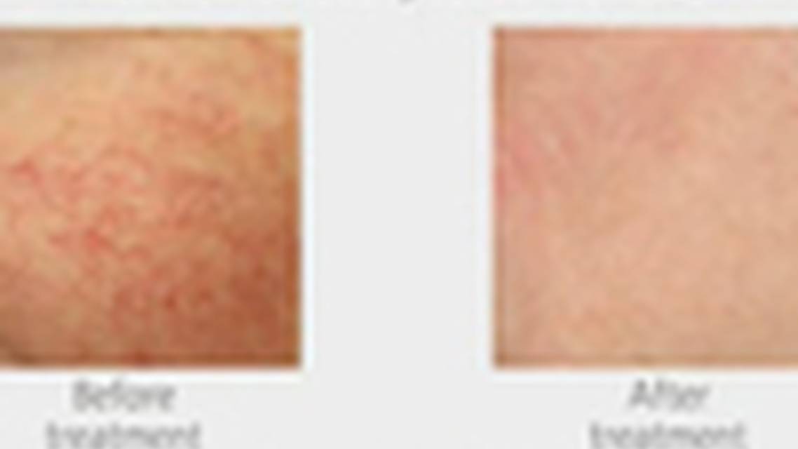 Thumbnail for domenoto