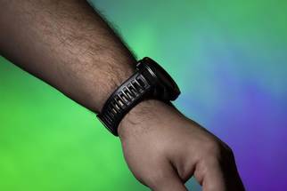Wristbands May Be Home to E coli Staph image