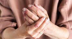 atopic dermatitis