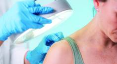 dermatology images