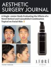 Study Retinol Plus CBD Maintains AntiAging Properties Minus Side Effects image