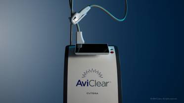 Cutera Announces International Commercial Launch of AviClear for the Treatment of Acne image