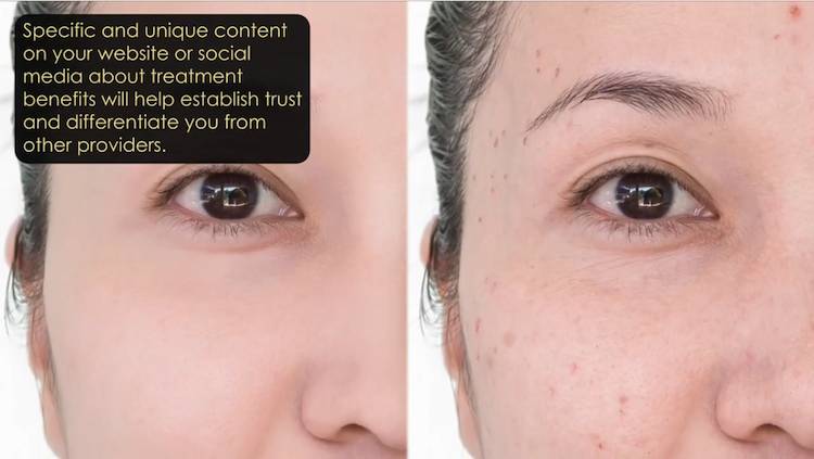 Five ways to promote new treatments thumbnail