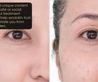 Five ways to promote new treatments thumbnail