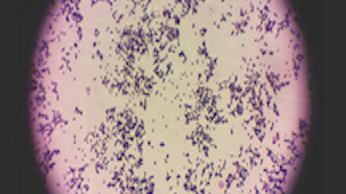 Staphylococcus aureus