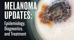 melanoma