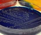 Looking Ahead Will Microbiome Diagnostics Usher in a Whole New Approach to Treating and Preventing Skin Disease image