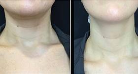 Now Trending TechNeck image