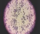 Staphylococcus aureus