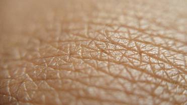 Revealed Why Skin Gets Leathery After Too Much Sun image