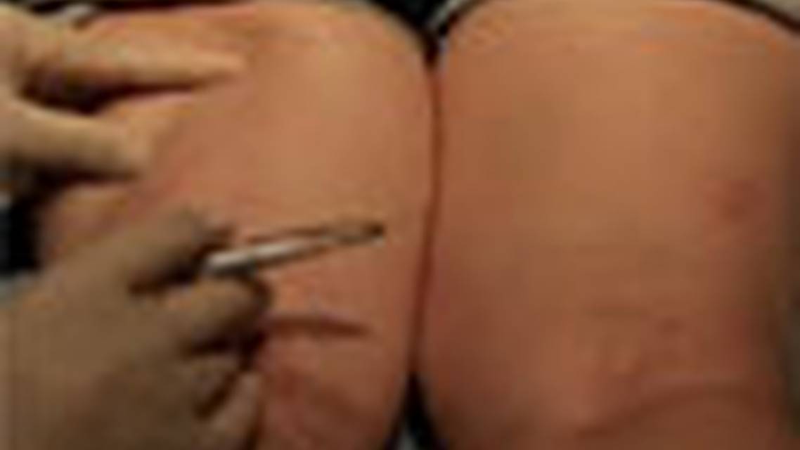 Thumbnail for fedolefe