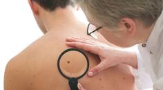 Skin Cancer 2024 Trends and Updates
