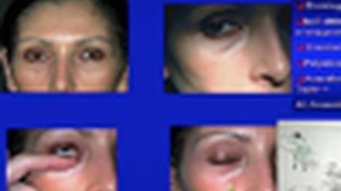 Thumbnail for jikogeti