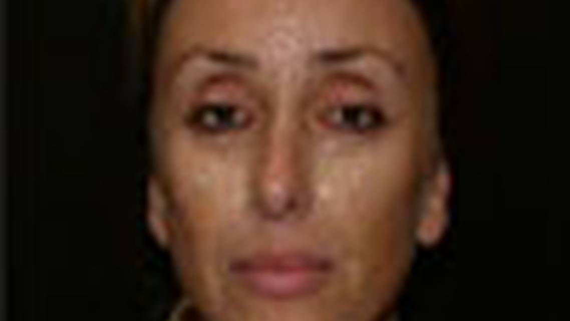 Thumbnail for toomedif