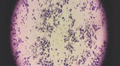 Staphylococcus aureus