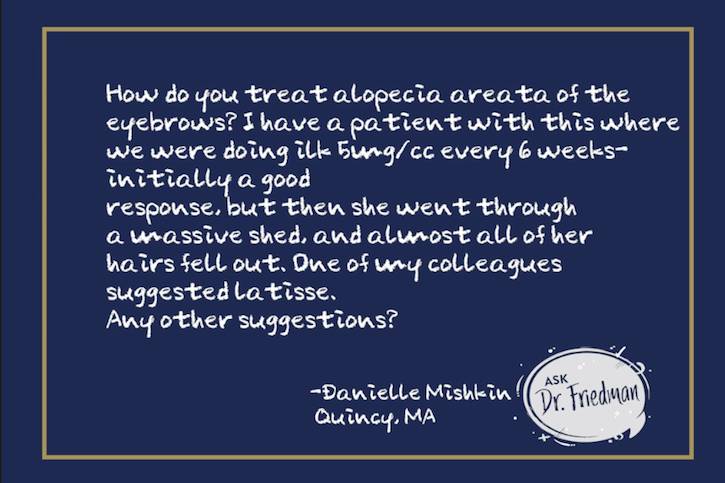 How Do You Treat Alopecia Areata of the Eyebrows thumbnail