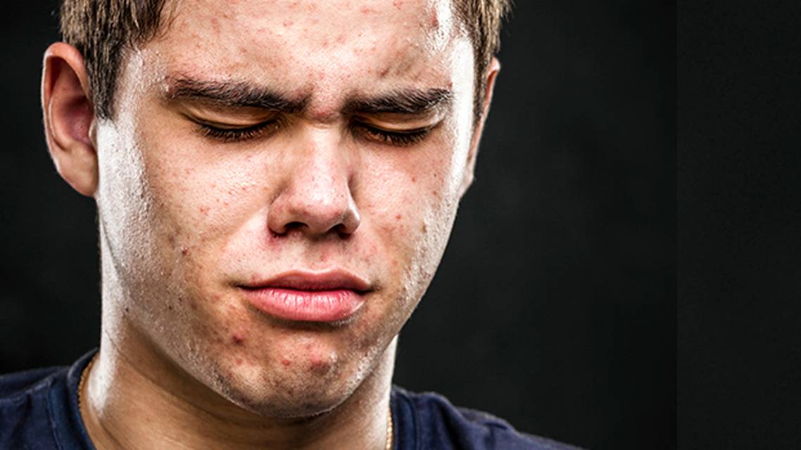 Isotretinoin Updates 2019 image