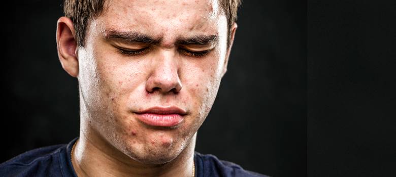 Isotretinoin Updates 2019 image