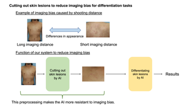 AI Model Helps AD patients Diagnose Complications Cancer image