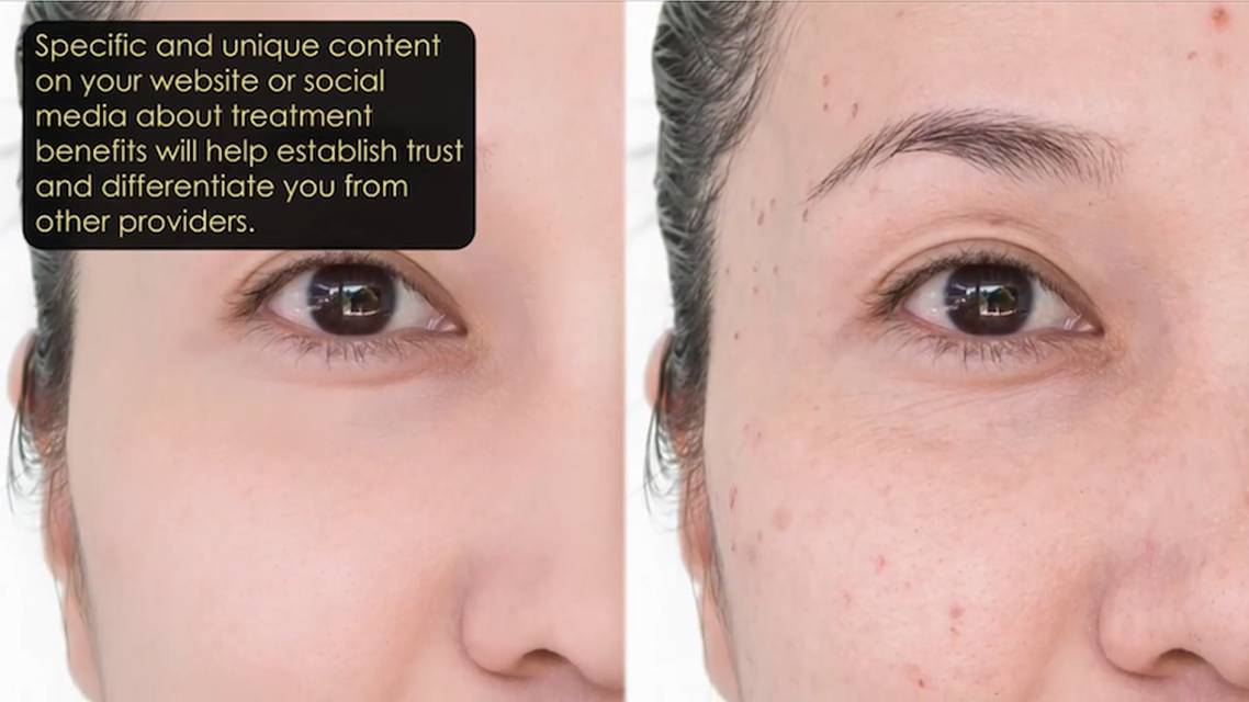 Five ways to promote new treatments thumbnail