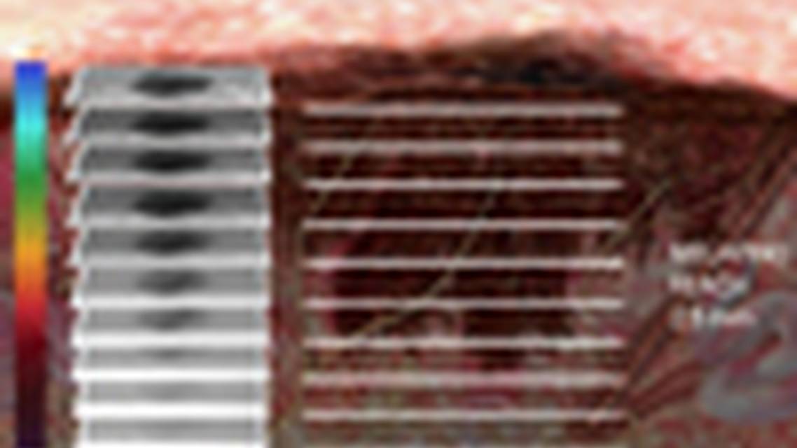 Thumbnail for dobiwawa