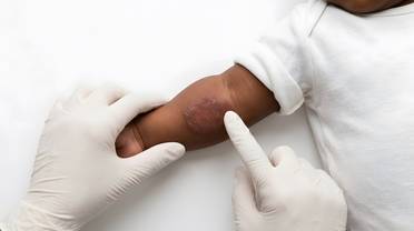 pediatric care disparities