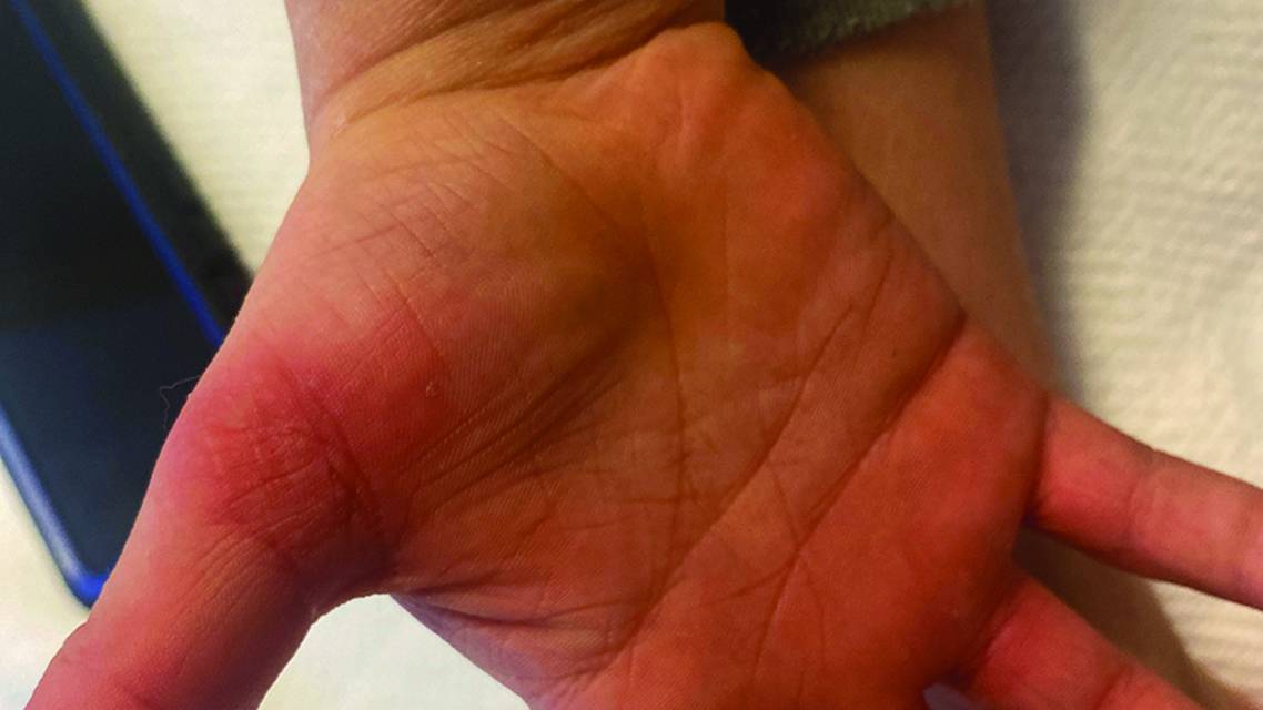 Rimmer et al case study