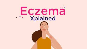Medicine X Launches Eczema Xplained Patient Story To Drive Understanding and Awareness of AD image