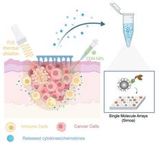New Platform May Help Determine Which Melanoma Patients Will Respond to Immunotherapy image