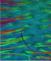 Optical Coherence Tomography Plus AI Can Quickly and Accurately Monitor Hair Regrowth image