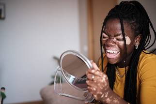 Does Vitiligoassociated Autoimmunity Reduce Morbidity and Mortality image