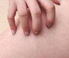 scratching