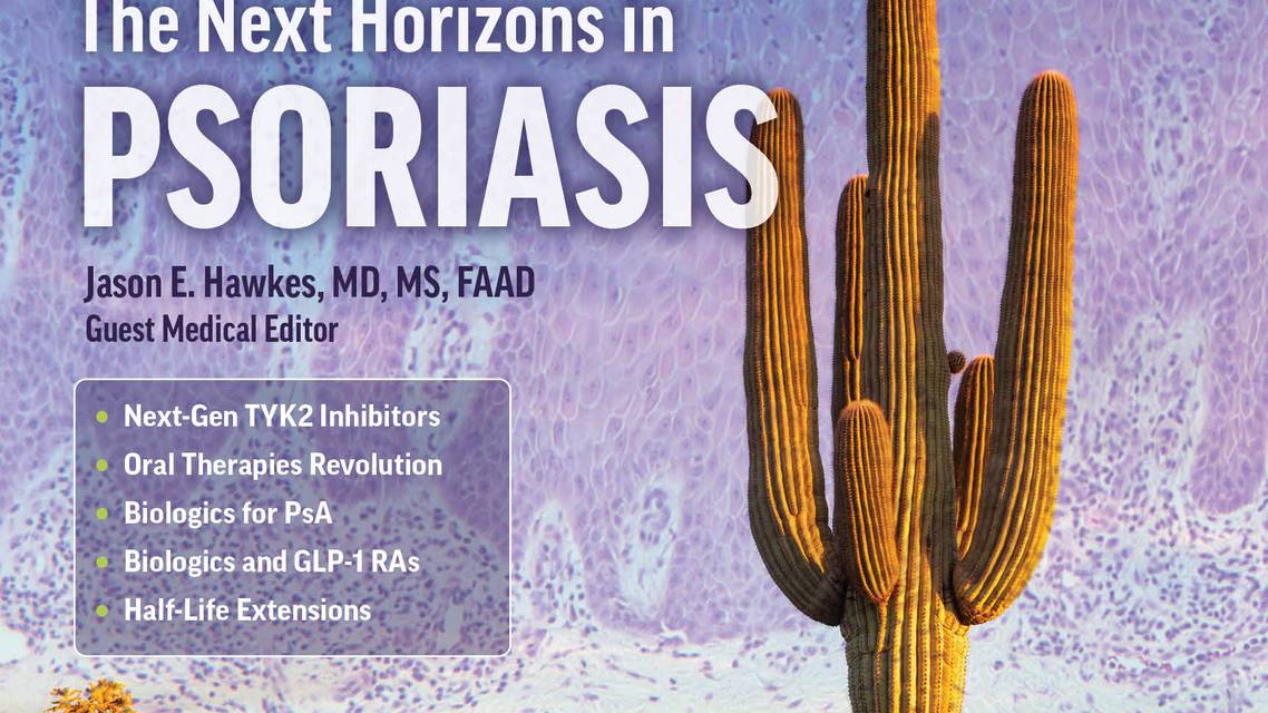 psoriasis