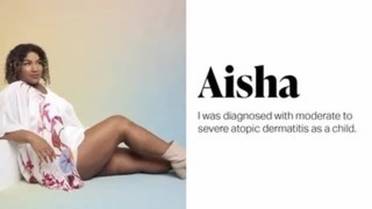 NEA Introduces New Focus on Eczema Campaign image