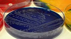 Looking Ahead Will Microbiome Diagnostics Usher in a Whole New Approach to Treating and Preventing Skin Disease image