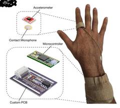 Smart Ring May Objectively Measure Scratching Intensity image