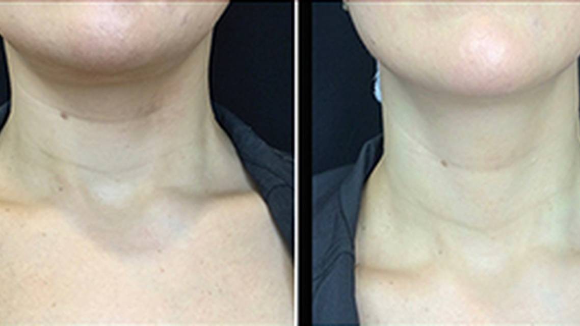 Now Trending TechNeck image