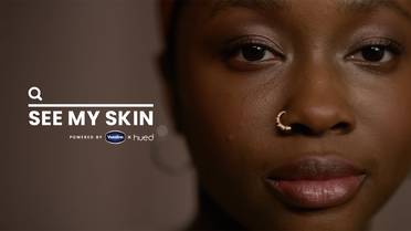 Vaseline Takes on Lack of Diversity in Skin Color Images with New Database image