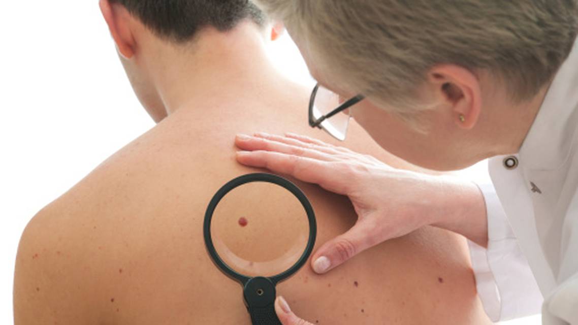 Skin Cancer 2024 Trends and Updates
