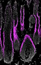 Hemoglobin Discovered in the Epidermis image