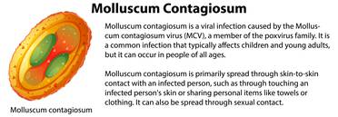 Molluscum Contagiosum Update Two New Treatments Come Down the Pike image