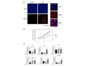 Revealed How Chronological Aging Affects EV Production by Human Keratinocytes image