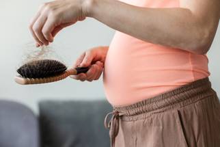 alopecia in pregnancy