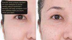 Five ways to promote new treatments thumbnail