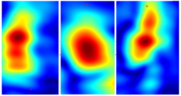 Handheld Device May Painlessly Identify Skin Cancers image