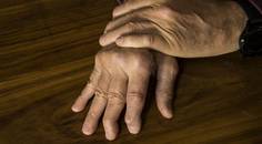 psoriasis