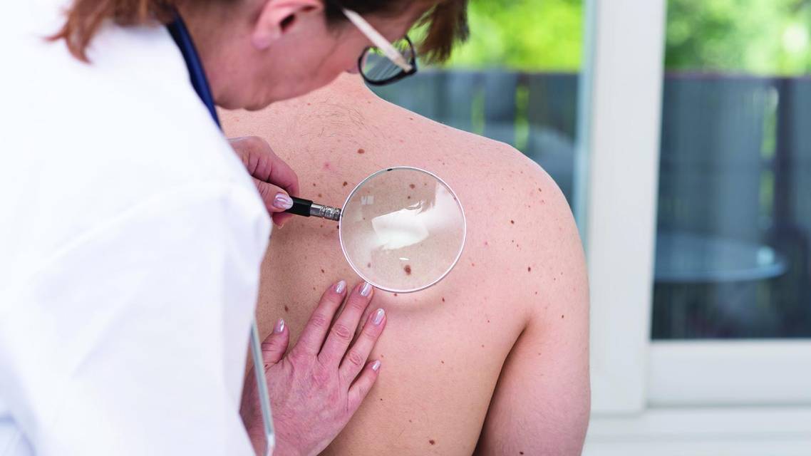 Exploring All Options for Treating Nonmelanoma Skin Cancer