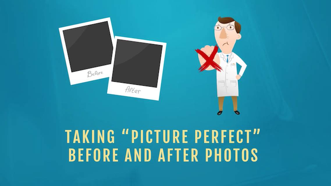 Taking picture perfect before and after photos thumbnail